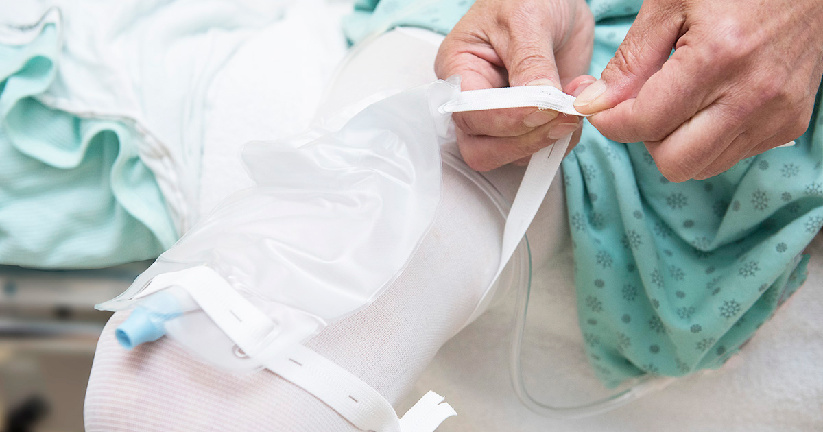 Taking Care Of A Catheter In The Bladder