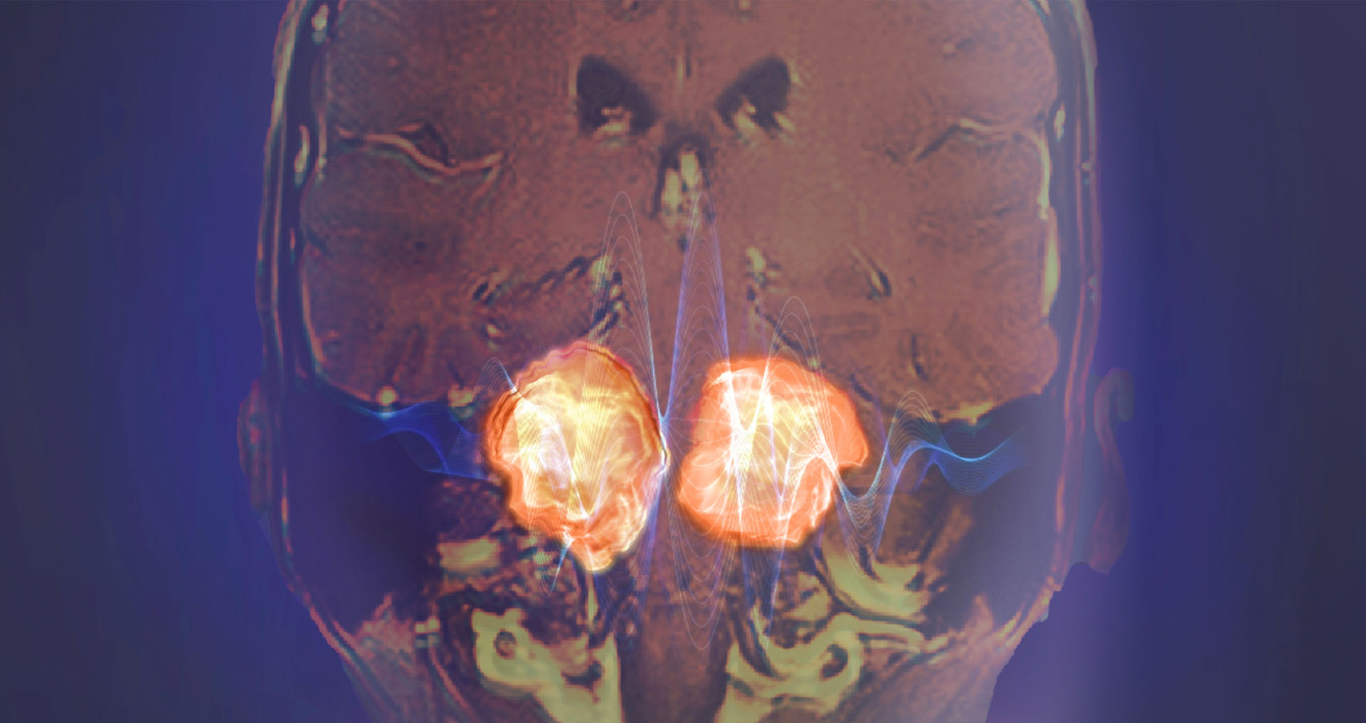 Symposium annuel de neuro-oncologie